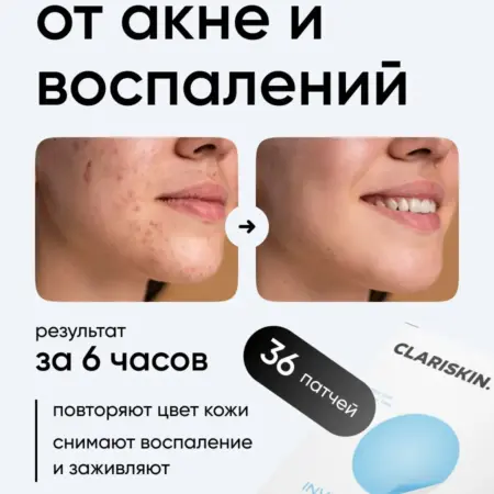 Патчи от прыщей прозрачные точечные маскирующие 36 шт. Clariskin
