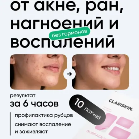 Патчи от прыщей прозрачные маскирующие большие. Clariskin