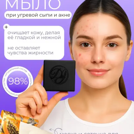 Лечебное черное мыло от прыщей и акне. Boho