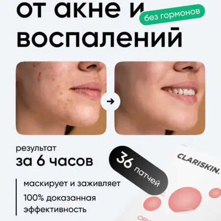 Патчи от прыщей и черных точек прозрачные маскирующие 36 шт. Clariskin