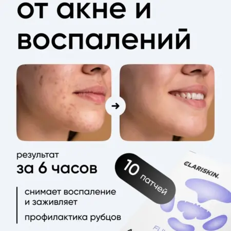 Патчи от прыщей для лица. Clariskin