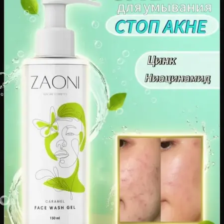 Гель для умывания от прыщей с ниацинамидом, 150мл. ZAONI cosmetics