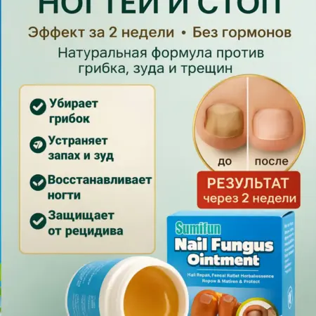 Китайское Средство от грибка ногтей 20 г. LAMIIA KING