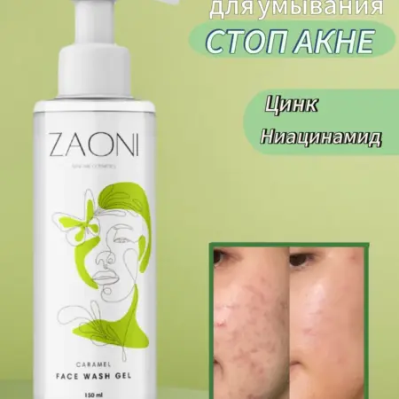 Гель для умывания от прыщей с ниацинамидом, 150мл. ZAONI cosmetics
