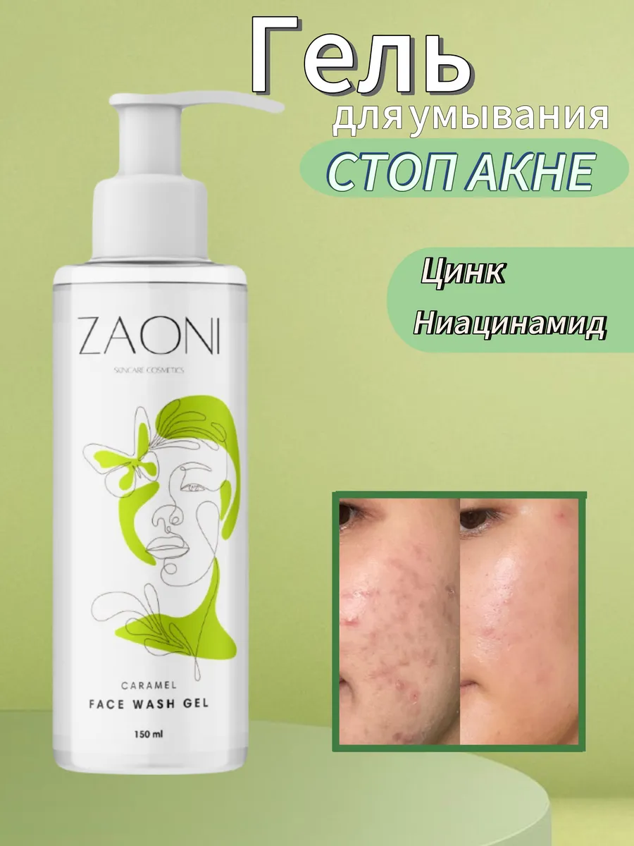 Гель для умывания от прыщей с ниацинамидом, 150мл. ZAONI cosmetics