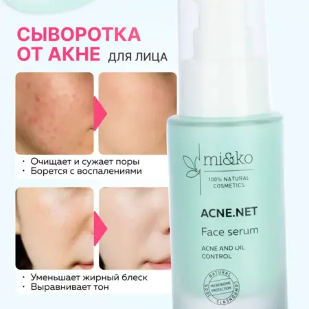 Азелаиновая сыворотка от акне от прыщей 10% + бакучиол. Эффективная косметика Miko и экохимия Pure Water