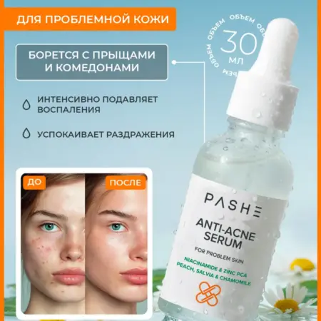 Сыворотка для лица прыщи комедоны ниацинамид уход. КАЛЬЕ - официальный производитель