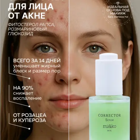 Сыворотка для лица от акне, от купероза, от розацеа. Эффективная косметика Miko и экохимия Pure Water