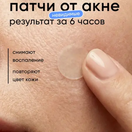Патчи от прыщей прозрачные точечные маскирующие 36 шт. Clariskin