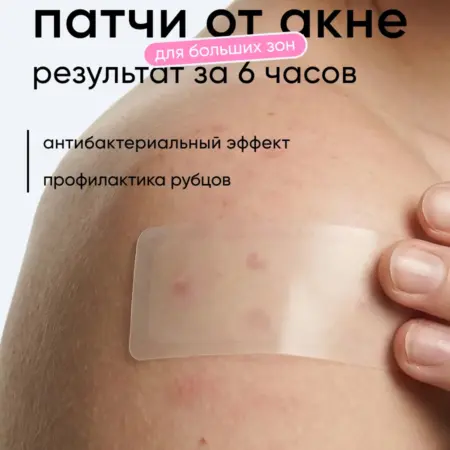 Патчи от прыщей прозрачные маскирующие большие. Clariskin