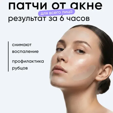 Патчи от прыщей для лица. Clariskin