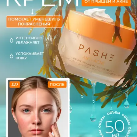 Крем для лица от прыщей и акне увлажняющий косметика. КАЛЬЕ - официальный производитель